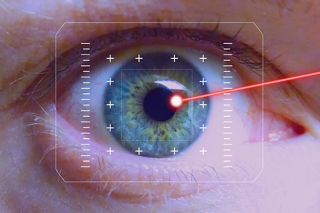 Laser Eye Surgery in London